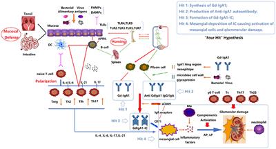 The Role of Immune Modulation in Pathogenesis of IgA Nephropathy